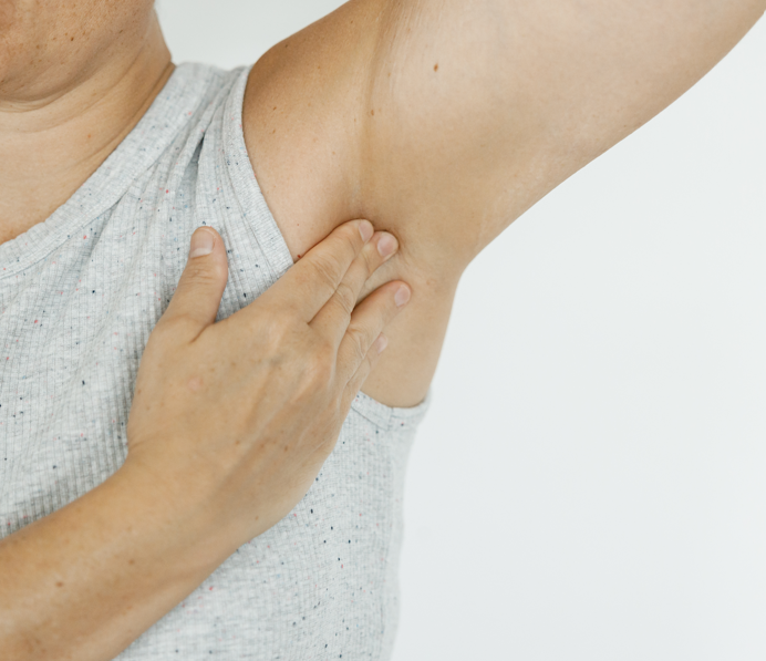 ¿Qué es la hidradenitis supurativa?